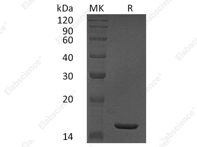 Recombinant Human TNF-alpha/TNFA Protein - 1