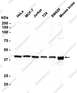 Recombinant cAMP Protein Kinase Catalytic subunit Monoclonal Antibody - 2