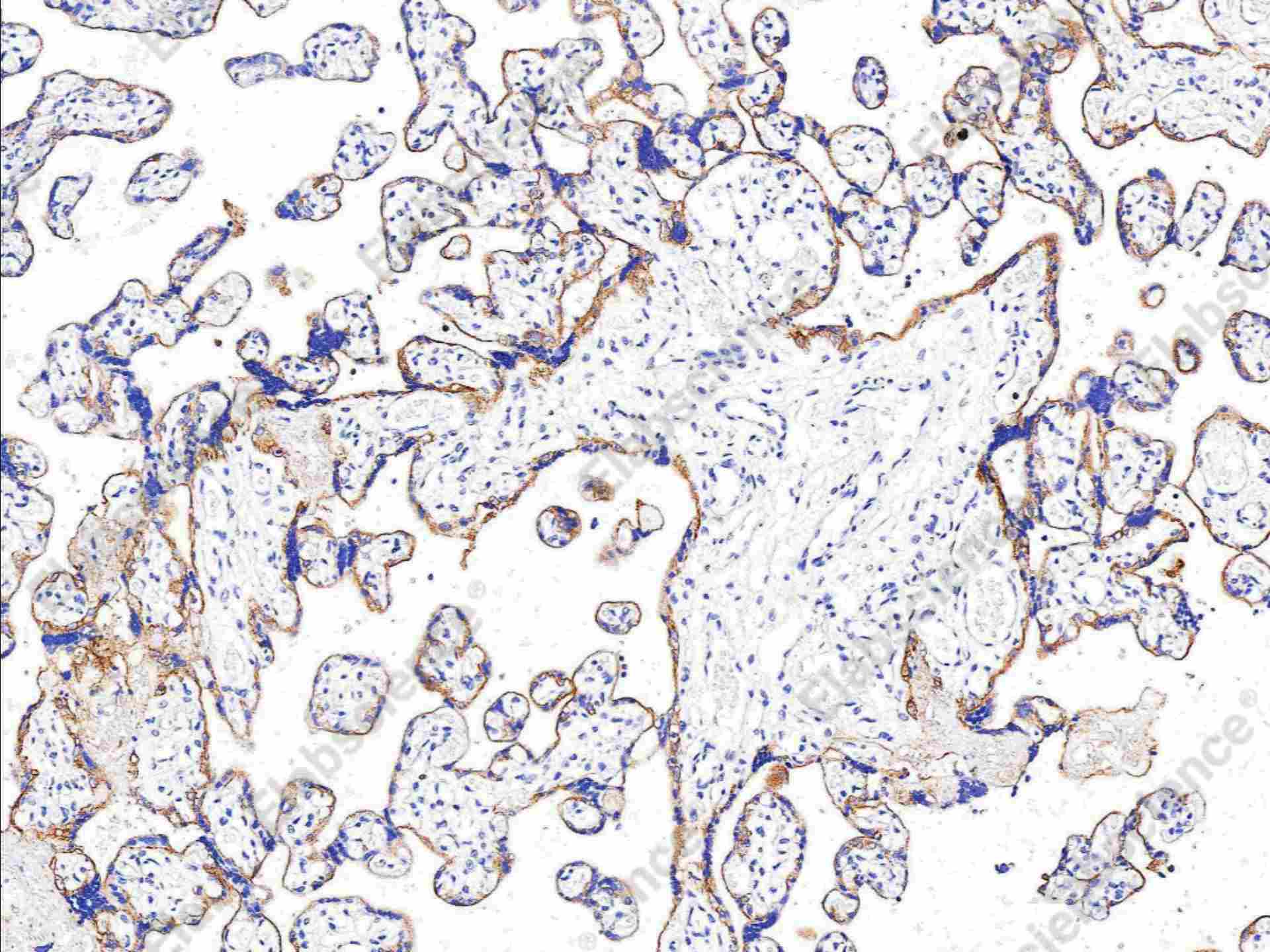 Recombinant EGFR/HER1/ErbB1 Monoclonal Antibody - 1