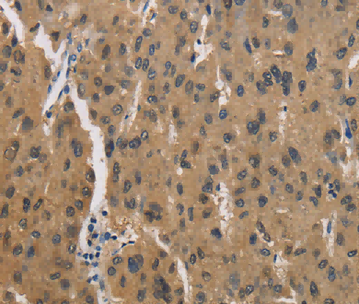 CKMT2 Polyclonal Antibody - 3