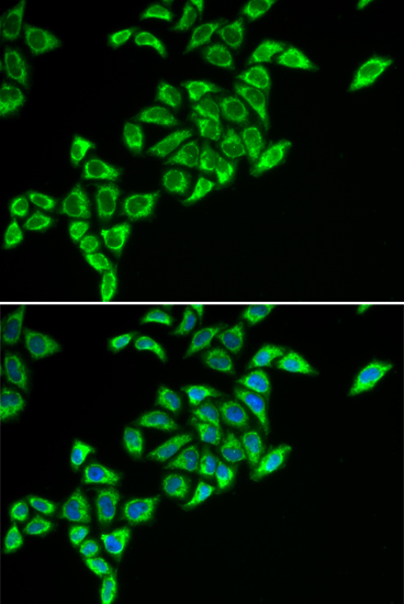 Immunofluorescence analysis of HeLa cells using DLAT Polyclonal Antibody