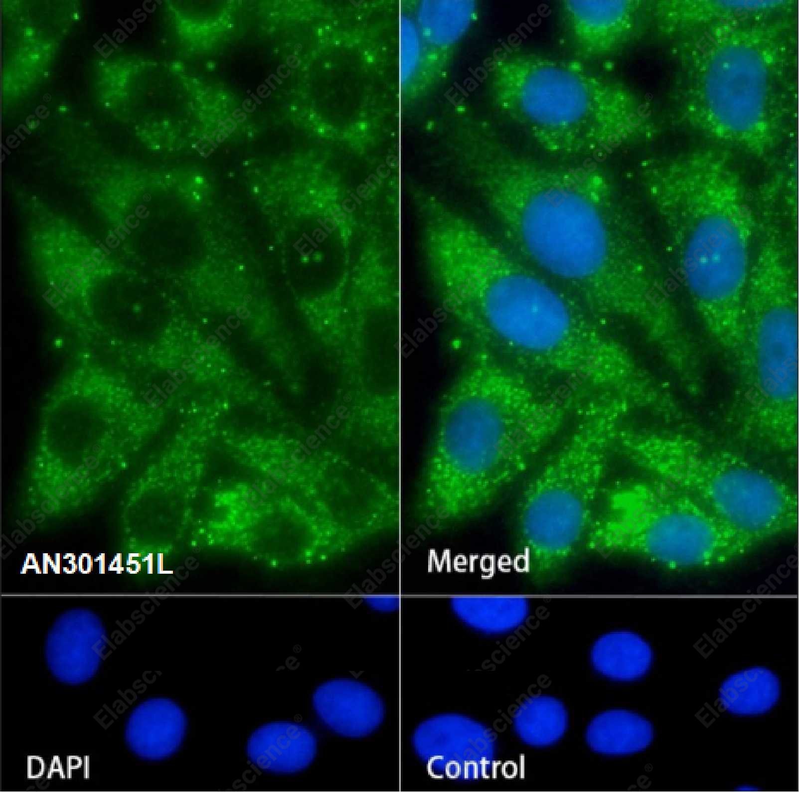 Recombinant Complement C4-B Monoclonal Antibody - 2
