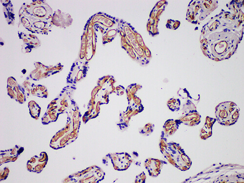 Immunohistochemistry of paraffinembedded Human placental tissue with CD31 Monoclonal Antibody(Antigen repaired by EDTA).