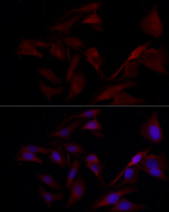 Immunofluorescence analysis of U2OS cells using TYK2 Polyclonal Antibody at dilution of 1:100 (40x lens). Blue: DAPI for nuclear staining.