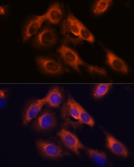 Immunofluorescence analysis of C6 cells using RAPH1 Polyclonal Antibody at dilution of  1:100. Blue: DAPI for nuclear staining.