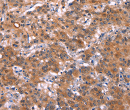 HMGCS1 Polyclonal Antibody - 2