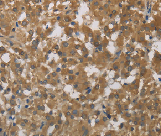 Cytochrome b5 Polyclonal Antibody - 2