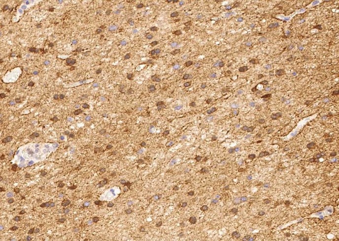 ENO2 Monoclonal Antibody-searchlist-1