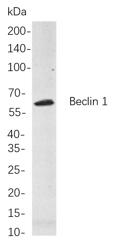 Recombinant Beclin 1 Monoclonal Antibody-searchlist-1
