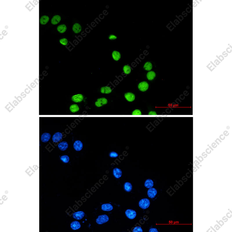 Recombinant ZBTB7A Monoclonal Antibody - 2
