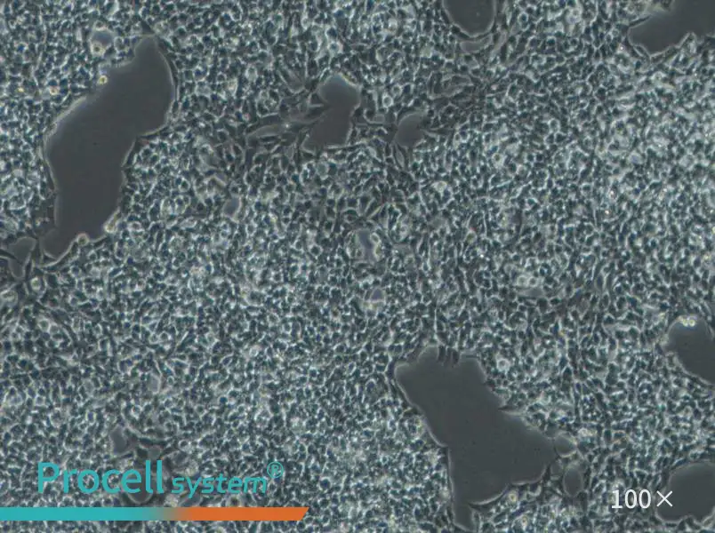 A-673 Cell Complete Medium - 2