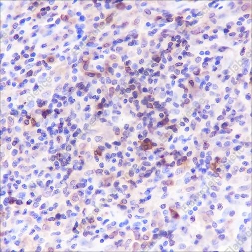 Recombinant HLA-DPA1 Monoclonal Antibody - 2