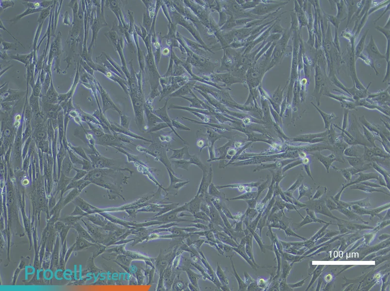 Human Umbilical Cord Mesenchymal Stem Cell Complete Medium - 1