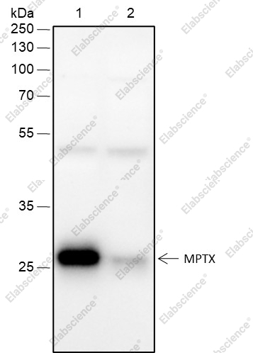 Recombinant MPTX Monoclonal Antibody - 1