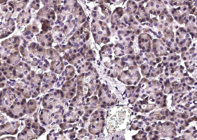 Recombinant STUB1 Monoclonal Antibody - small - 3