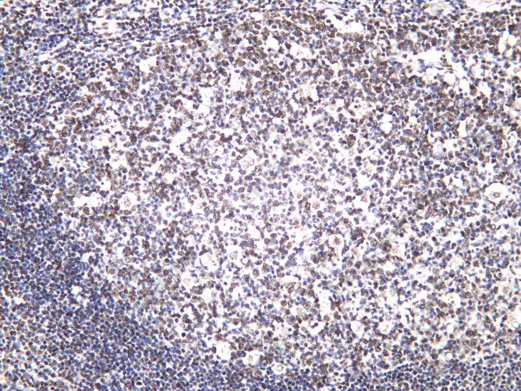 Recombinant Histone H4 (Acetyl Lys12) Monoclonal Antibody - 2