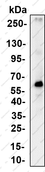 Recombinant ALDH1A2 Monoclonal Antibody - 4
