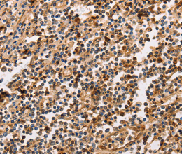 PPP1CB Polyclonal Antibody - 2