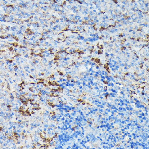 Immunohistochemistry of paraffin-embedded mouse spleen using Gelsolin Polyclonal Antibody at dilution of 1:50 (40x lens).Perform high pressure antigen retrieval with 10 mM citrate buffer pH 6.0 before commencing with IHC staining protocol.