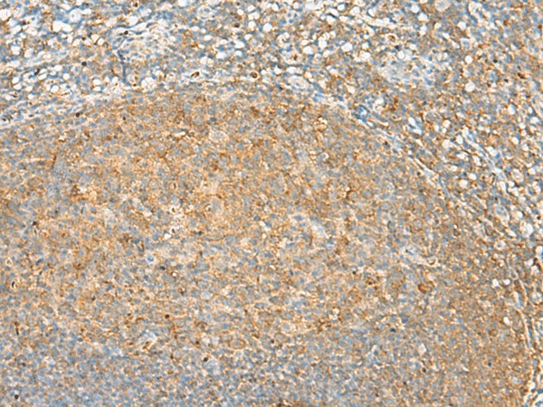 Immunohistochemistry of paraffin-embedded Human tonsil tissue  using GRHPR Polyclonal Antibody at dilution of 1:30(?200)