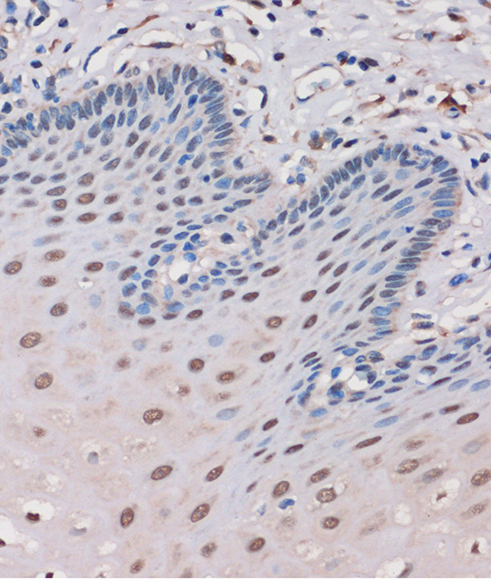 Immunohistochemistry of paraffin-embedded Human esophageal using MTMR8 Polyclonal Antibody at dilution of 1:100 (40x lens).Perform microwave antigen retrieval with 10 mM PBS buffer pH 7.2 before commencing with IHC staining protocol.