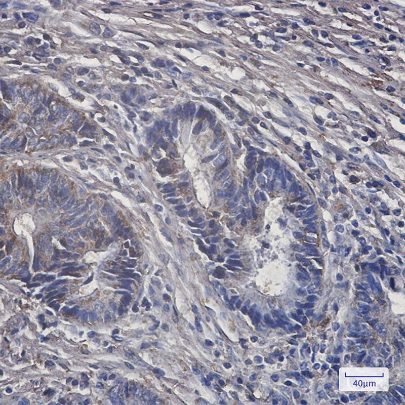 Recombinant PCK2 Monoclonal Antibody - 3
