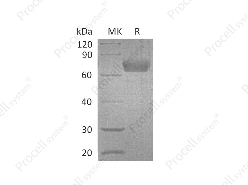 IL-4R&alpha; (C-Fc), Mouse, Recombinant