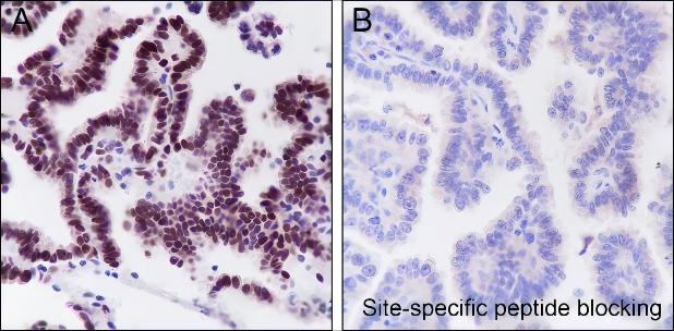 Recombinant JunB Monoclonal Antibody - 2