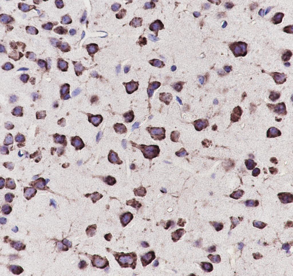 Recombinant eEF1A2 Monoclonal Antibody - small - 4