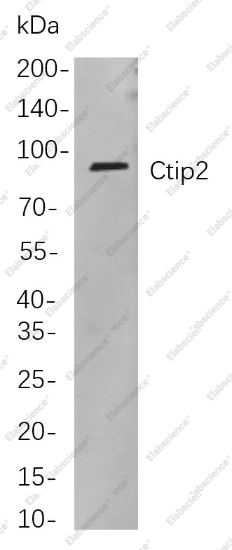 Recombinant Ctip2 Monoclonal Antibody - 1