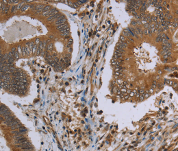 MAVS Polyclonal Antibody - 2
