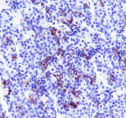 Recombinant ACTH Monoclonal Antibody - 2