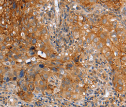 PLAUR Polyclonal Antibody - 3