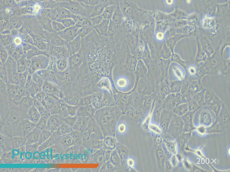 HCC-78 Cell Complete Medium - 6
