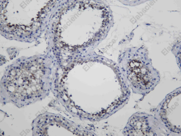 Recombinant SHLB1 Monoclonal Antibody - 1