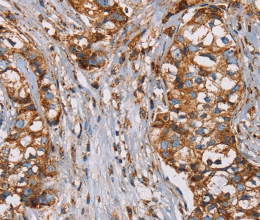NDUFS1 Polyclonal Antibody - 2