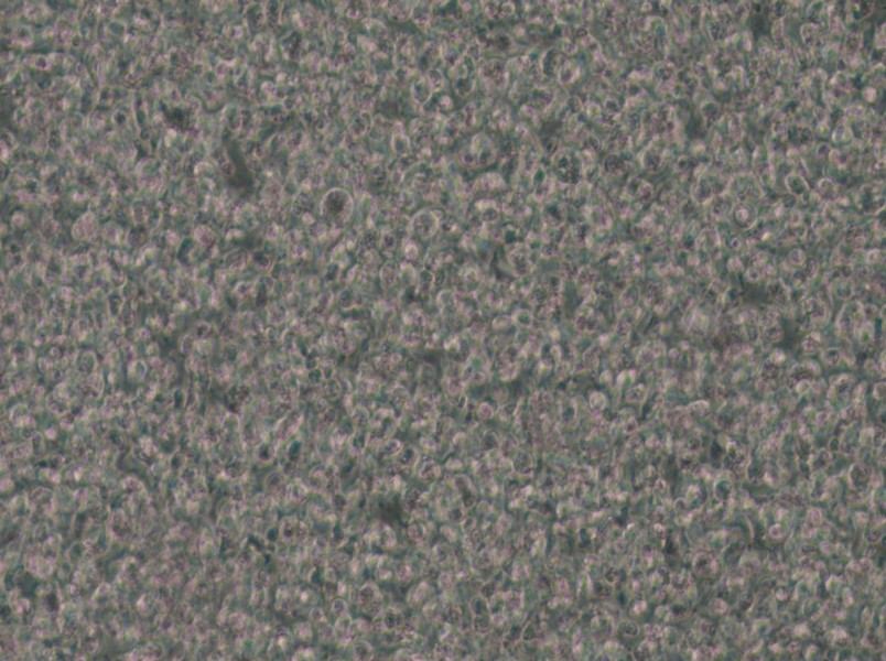 SU-DHL-1 Cell Complete Medium - small - 5