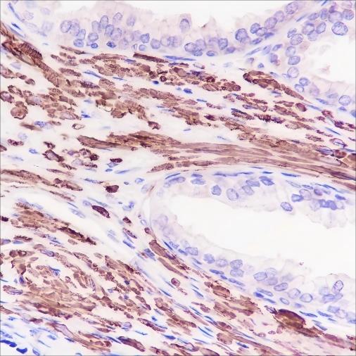 Recombinant alpha smooth muscle Actin Monoclonal Antibody - 3