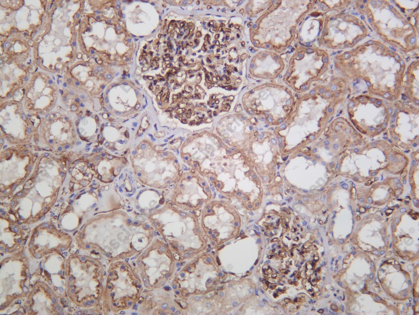 Recombinant B2M/beta-2 microglobulin Monoclonal Antibody - 3