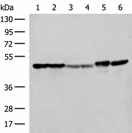 Western blot analysis of Hela A375 Human fetal liver tissue Human fetal brain tissue HepG2 cell and Mouse brain tissue lysates  using FLOT2 Polyclonal Antibody at dilution of 1:350