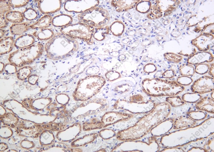 Recombinant Phospho-eNOS (Ser1177) Monoclonal Antibody - 1