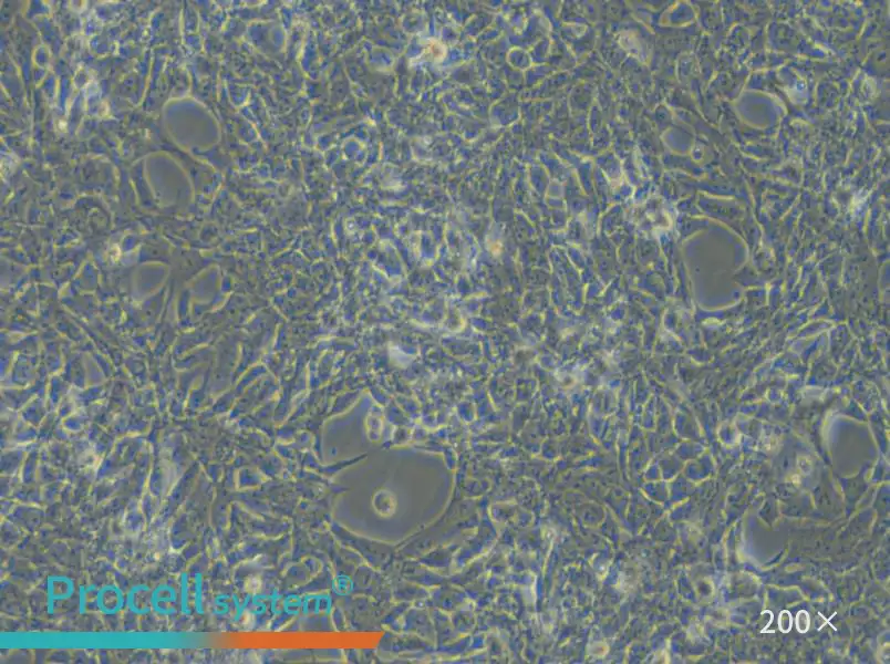 SBC-3 Cell Complete Medium - small - 4
