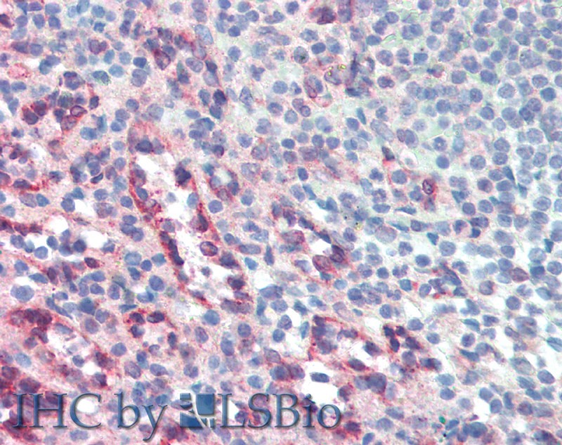 Immunohistochemistry of paraffin-embedded Small Intestine (MALT) tissue using CD272 Polyclonal Antibody at dilution of 1:50 (Elabscience Product Detected by Lifespan).