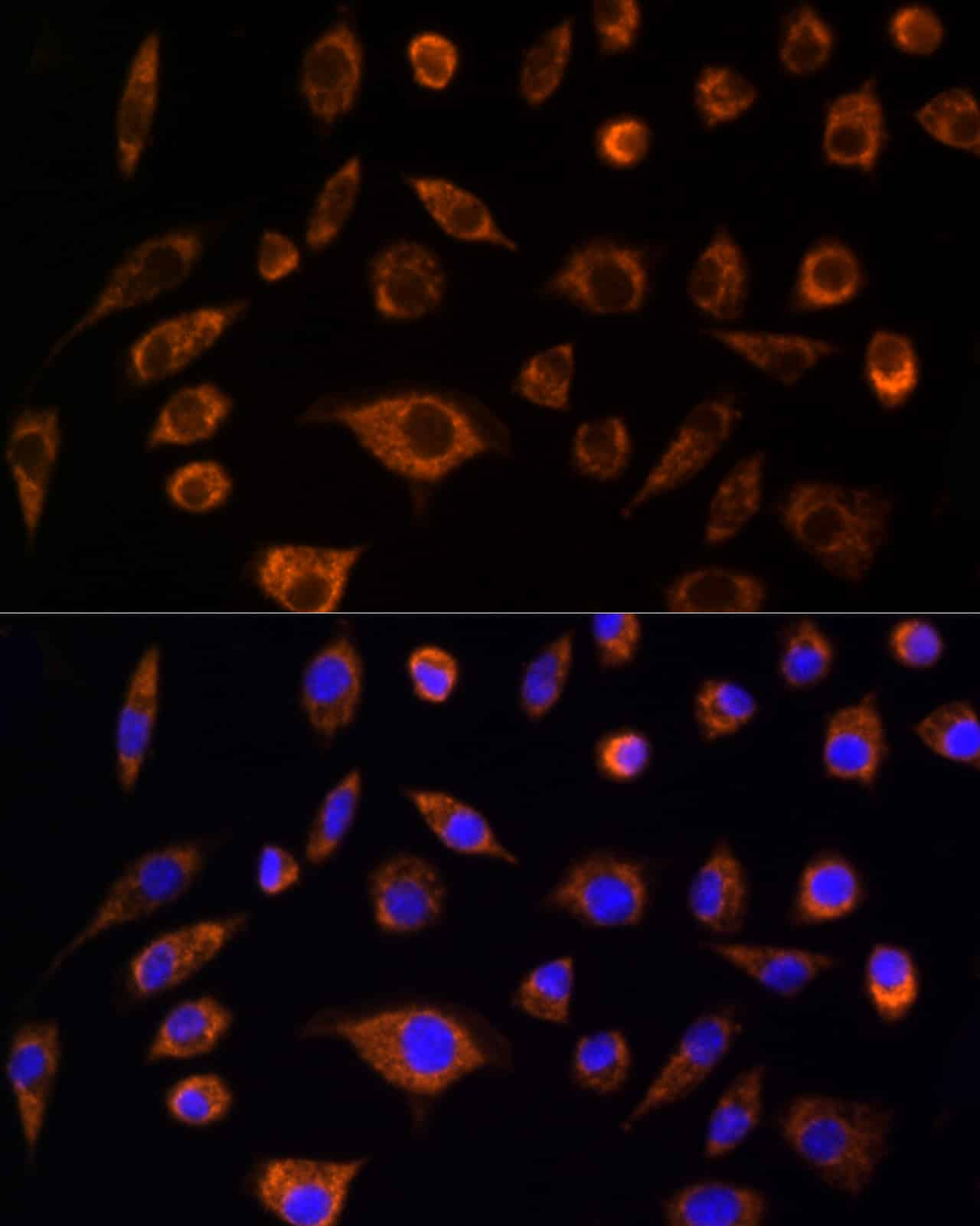 Immunofluorescence analysis of L929 cells using AIF Polyclonal Antibody at dilution of 1:100 (40x lens). Blue: DAPI for nuclear staining.