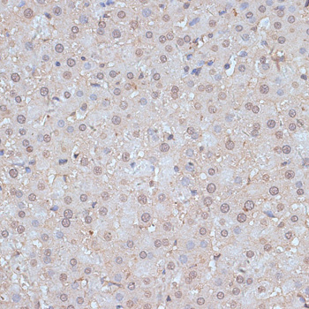 Immunohistochemistry of paraffin-embedded Rat liver using SNW1 Polyclonal Antibody at dilution of  1:100 (40x lens).