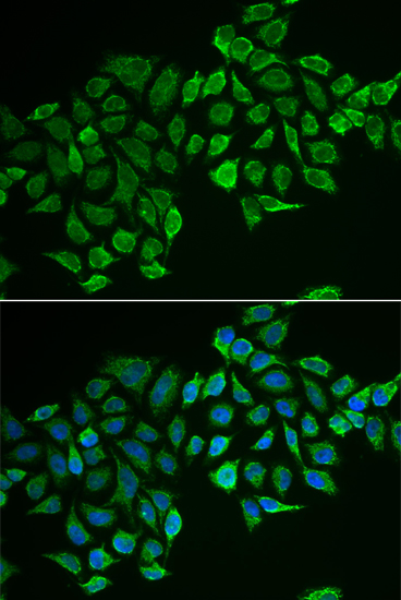 Immunofluorescence analysis of MCF-7 cells using RHOD Polyclonal Antibody