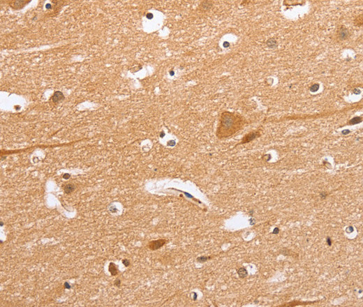 Immunohistochemistry of paraffin-embedded Human brain tissue using BLNK Polyclonal Antibody at dilution 1:50