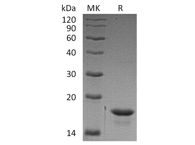 Recombinant Human 4E-BP1/EIF4EBP1 Protein (His Tag)