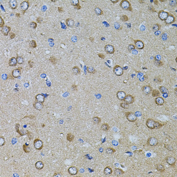 Immunohistochemistry of paraffin-embedded Rat brain using Gm13125 Polyclonal Antibody at dilution of 1:100 (40x lens).