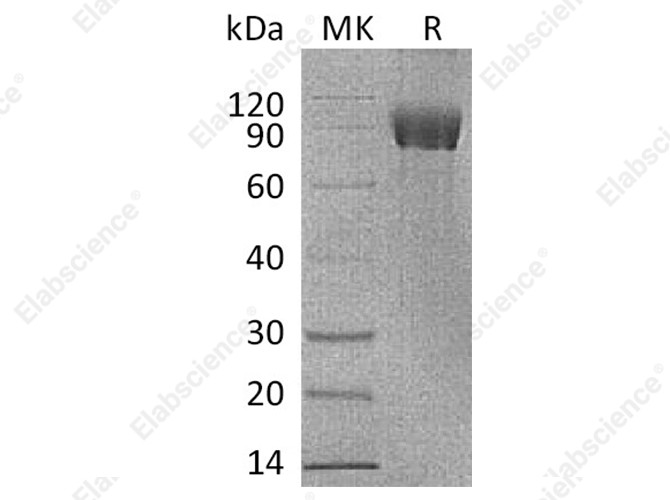 Recombinant Human IL-1R8/IL1RAPL1 Protein (Fc Tag) - 1